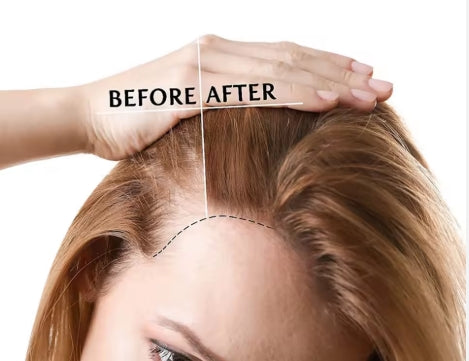 HAIR GROWTH CAP - LED RED LIGHT THERAPY HAT